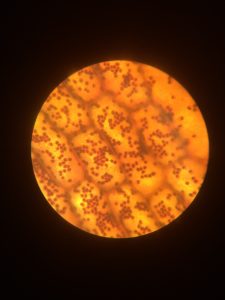 Cellules d'élodée observées au mircoscope optique (x400) coloration au lugol.